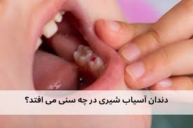 آیا دندان آسیاب می افتد