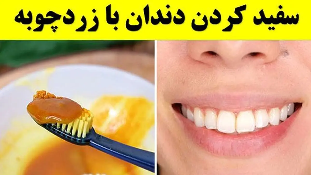 چطور با زردچوبه دندان را سفید کنیم
